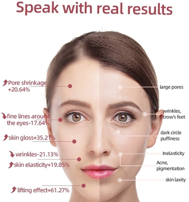 46G การอุ่นเครื่อง Anti Aging Eye Massager Pen Wand สําหรับใบหน้า คอ ตา ตา ร่างกาย EMS ไมโครคอเรนต์